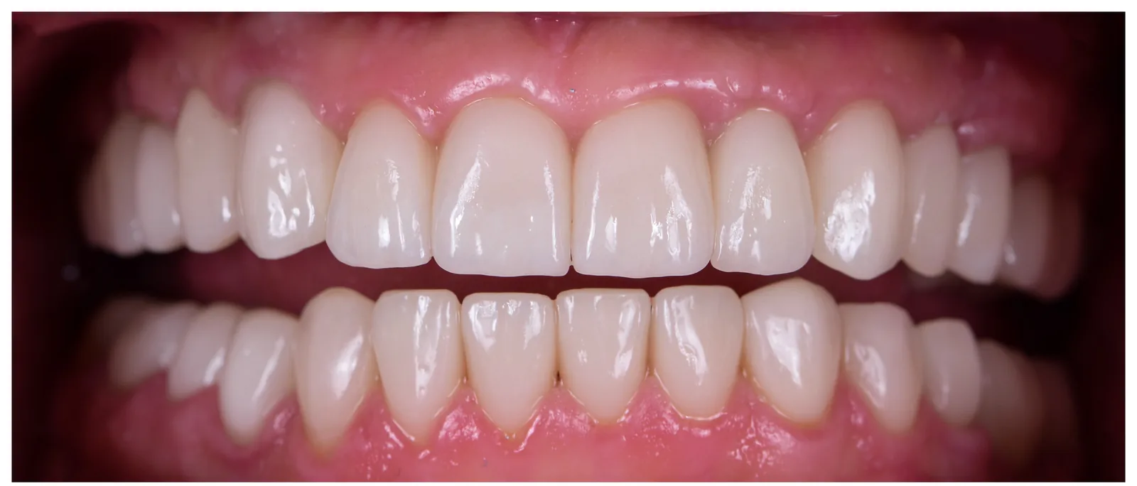 After dental makeover