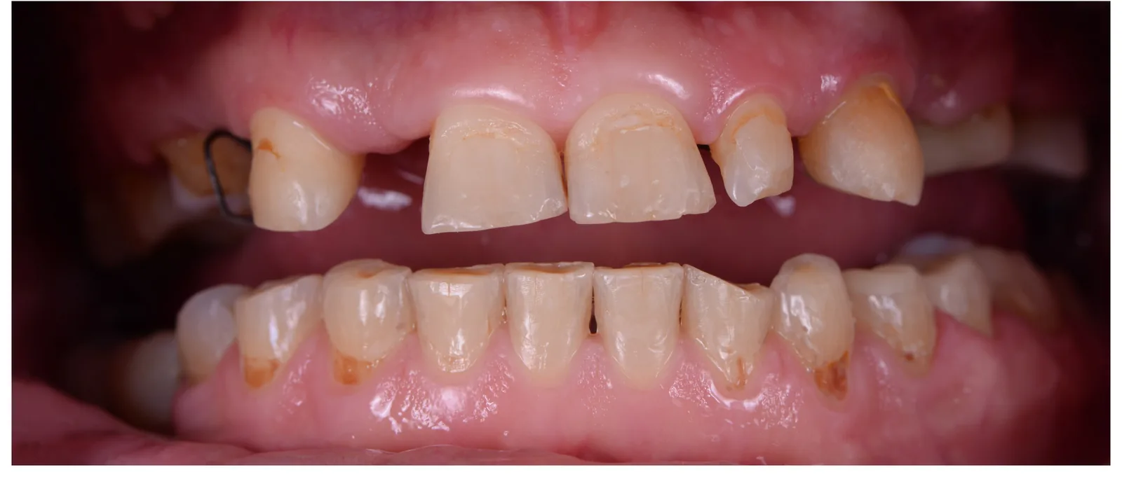 Before dental makeover