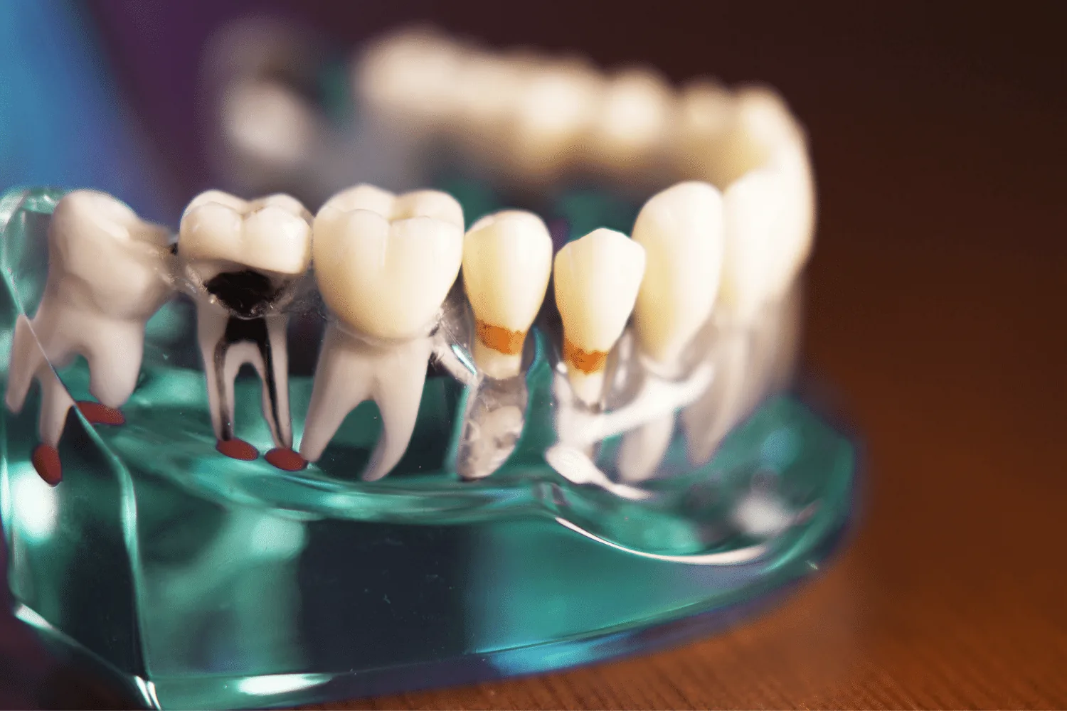 Deep cleaning scaling and root planing at Astra Dental Franklin Park IL