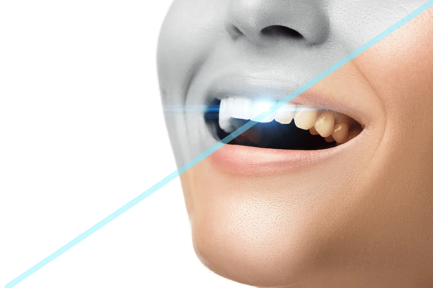 Dental exam and cleaning at Astra Dental in Franklin Park IL