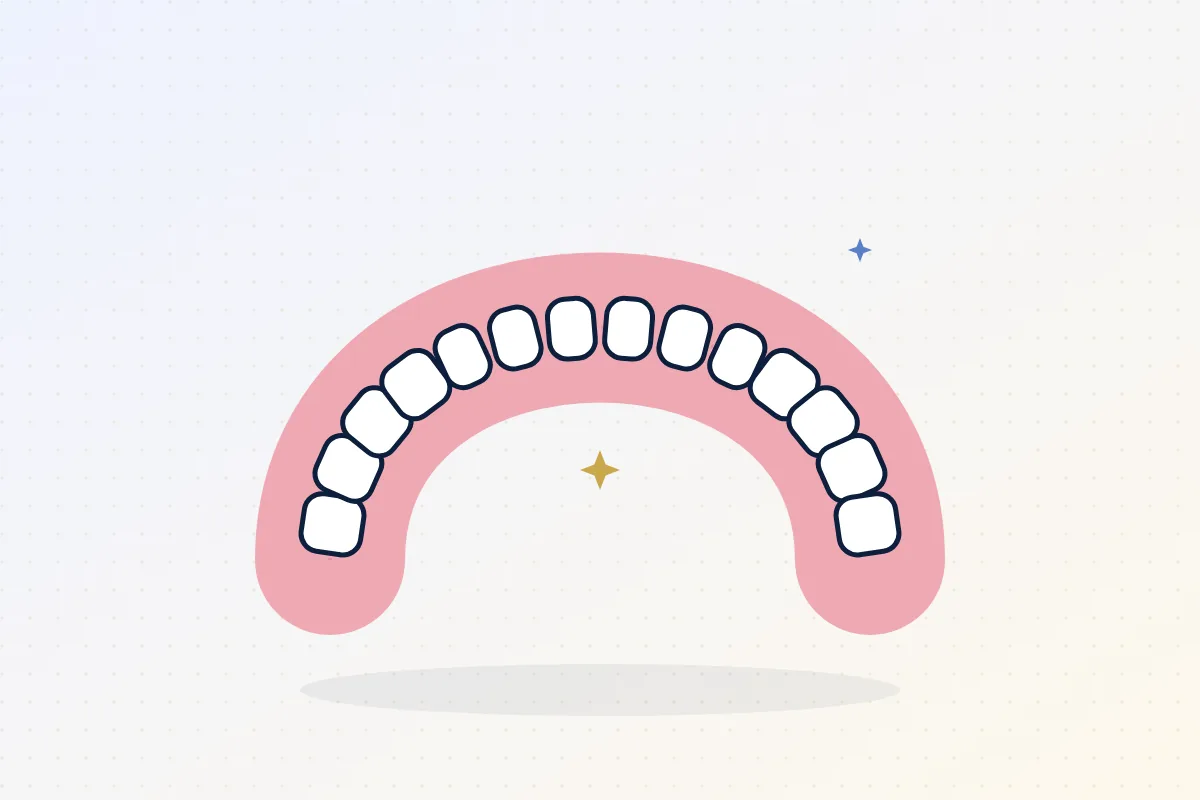 Illustration of a full upper denture with teeth set on a pink gum base