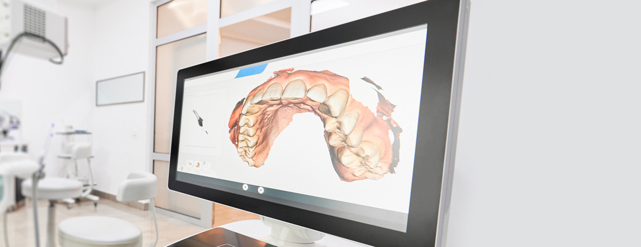 CAD/CAM Dentistry