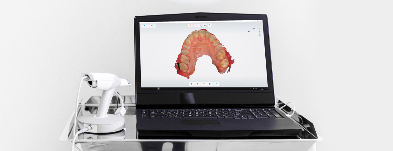 Intraoral Scanner